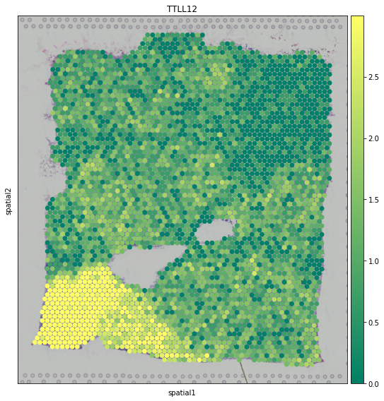 ../_images/tutorials_denoising_and_meta_genes_10_0.png