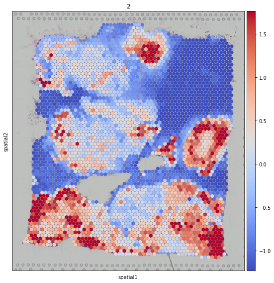 ../_images/tutorials_denoising_and_meta_genes_23_0.png