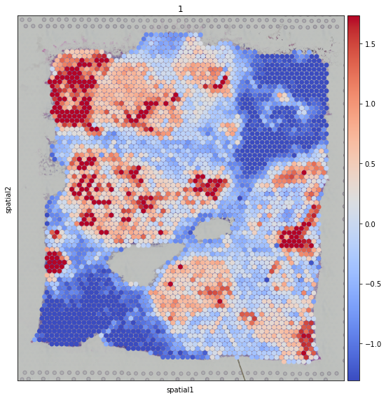 ../_images/tutorials_denoising_and_meta_genes_22_0.png
